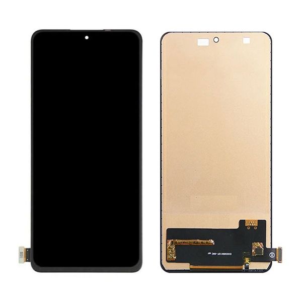 Thay màn hình Xiaomi Redmi Note 11 5g